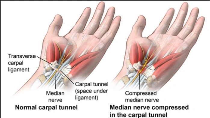 Doctors for Nerve Pain in Gurgaon